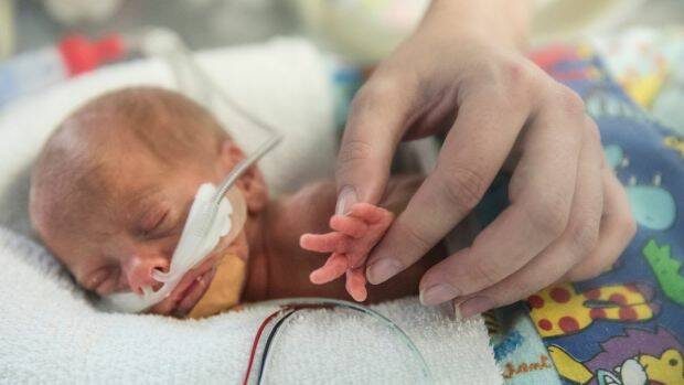 Morning Buzz: Simple technique to save thousands of premature babies