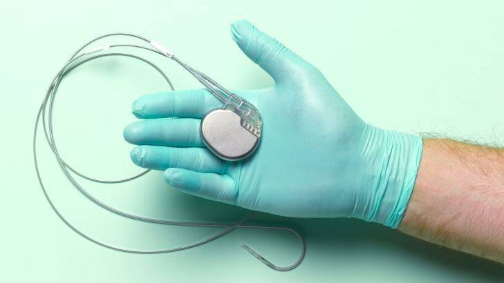 Heart pacemakers are used to treat arrhythmias. Photo: Peter Dazeley