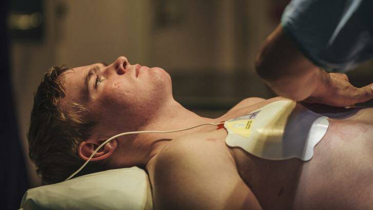 A patient is fitted with a pacemaker. Photo: Rohan Thomson