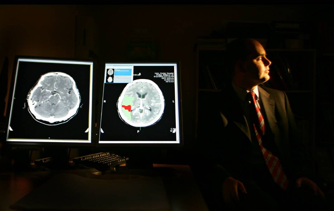 Rapid assessment critical: A doctor analyses scans of a recent stroke victim. Picture: Kitty Hill