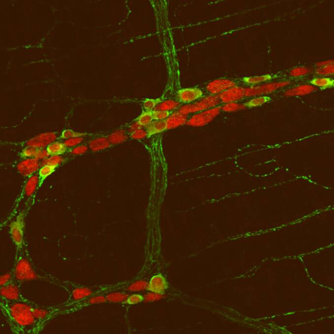 Clinical discovery: This show the neurons in the gut of a mouse with the autism-related gene mutation. The study found mice with the mutation had more neurons in the small intestine.