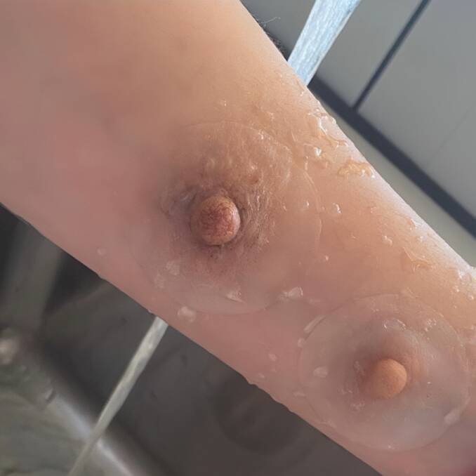 An example of silicone nipple prosthetics. Picture supplied