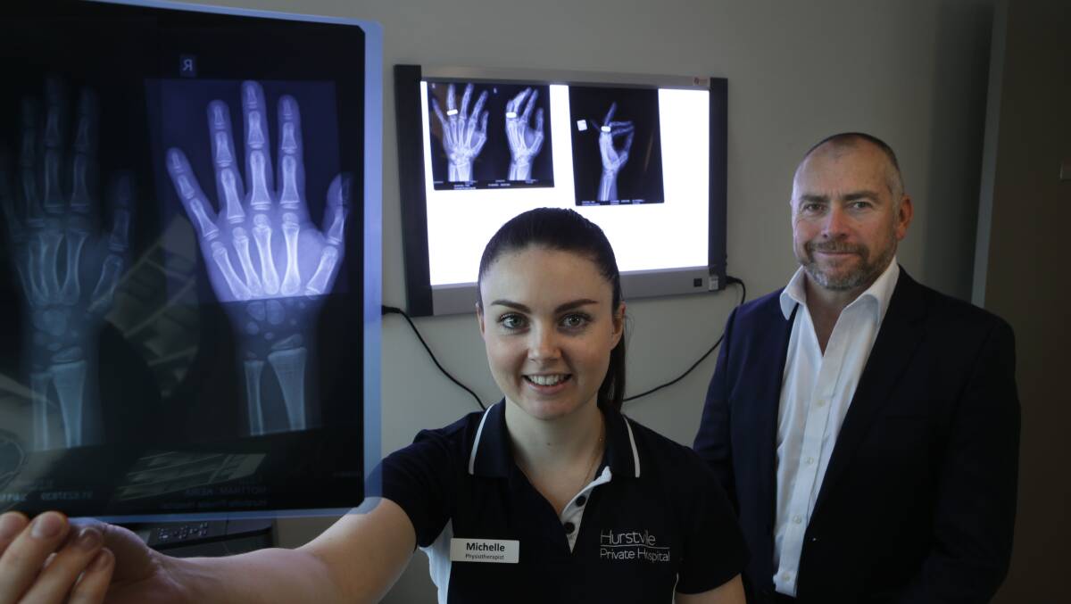 Fracture help: Hurstville Private Hospital's senior physiotherapist Michelle Kelly and sport and exercise physician Dr Michael Jamieson. Picture: John Veage