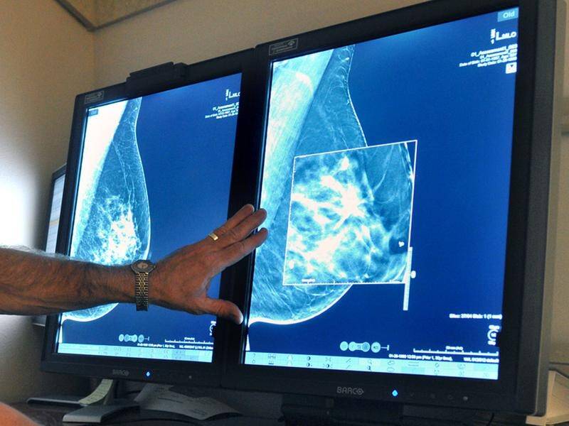 A new test may predict the return of breast cancer in some patients, according to a recent study.