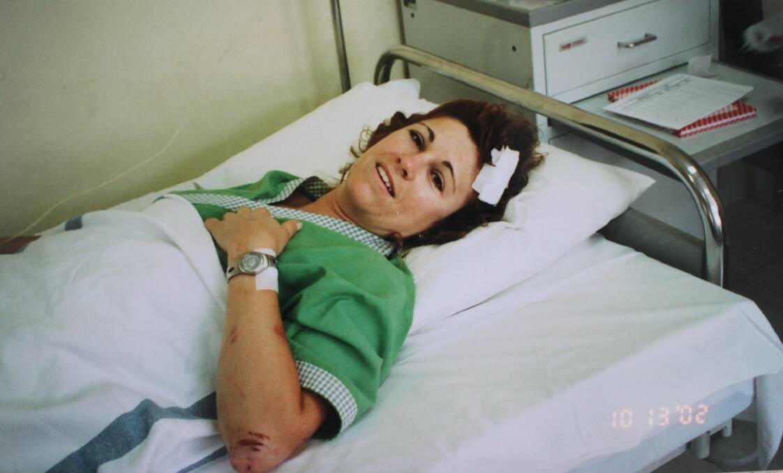Survivor: Bali bombings victim Carren Smith lies injured in a Bali hospital.